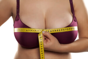 Who is a candidate for breast reduction - Dr. Fichadia